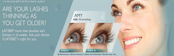 eylashes growth with careprost latisse sm