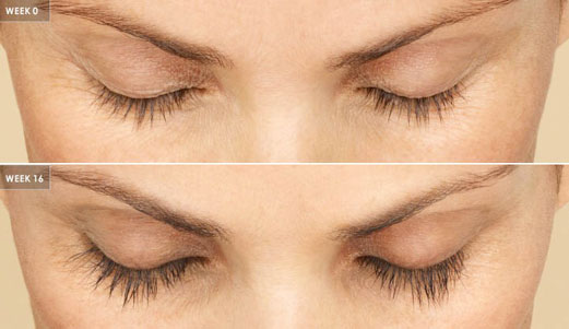 lumigan latisse careprost eyelash extension before after