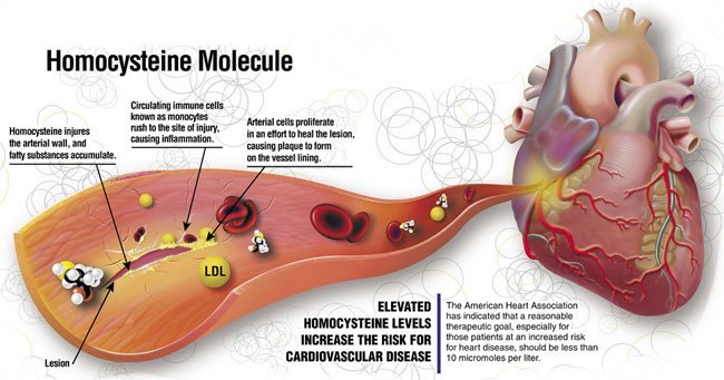 Homocysteine levels