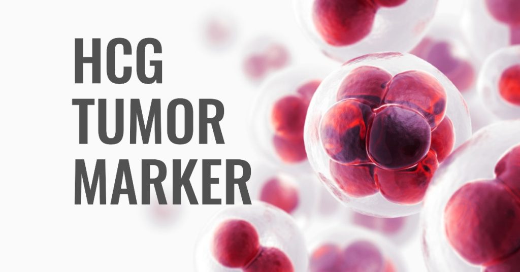 HCG tumor marker 1